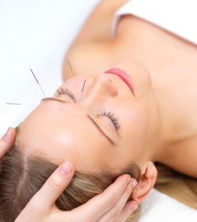 Massage soorten acupunctuur